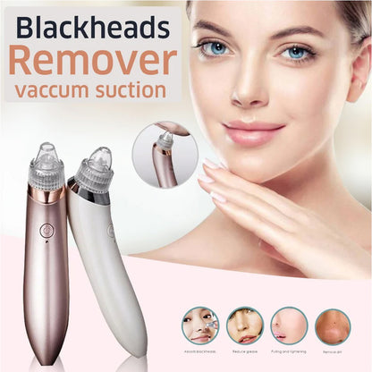 5 in 1 Derma Suction Blackhead Remover | Electric Pore Vacuum & Acne Cleaner for Face