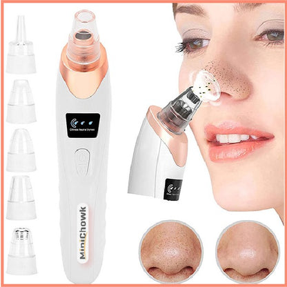 5 in 1 Derma Suction Blackhead Remover | Electric Pore Vacuum & Acne Cleaner for Face